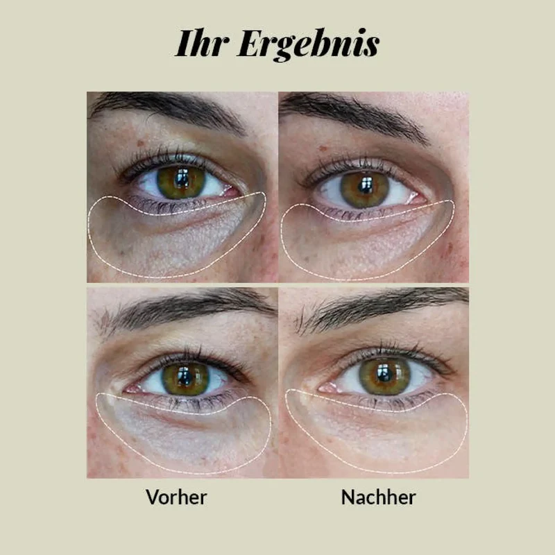 CBD Augencreme mit Hyaluronsäure