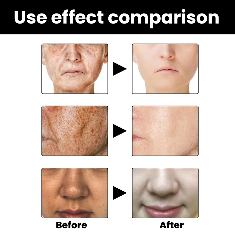 Facial Melanin Repair Hydrating Skincare Products