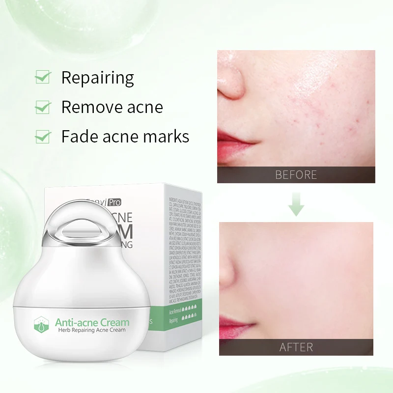 Herbal Skin care lotion Moisturizing Facial Cream Skin Care Products